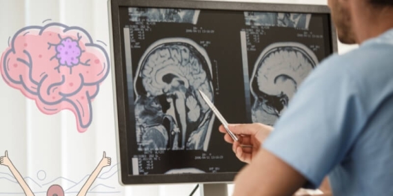 Beyin Tümörü Ameliyatı: Süreç, Riskler ve Modern Cerrahi Yöntemler