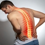 Vertebroplasti: Osteoporotik Omurga Kırıklarında Modern Tedavi Yöntemi