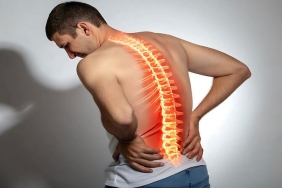 Vertebroplasti: Osteoporotik Omurga Kırıklarında Modern Tedavi Yöntemi