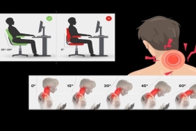 Boyun Ağrısı Günümüzde Neden Çok Arttı? Modern Yaşamın Sessiz Epidemisi
