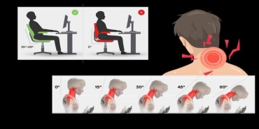 Boyun Ağrısı Günümüzde Neden Çok Arttı? Modern Yaşamın Sessiz Epidemisi