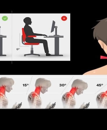 Boyun Ağrısı Günümüzde Neden Çok Arttı? Modern Yaşamın Sessiz Epidemisi
