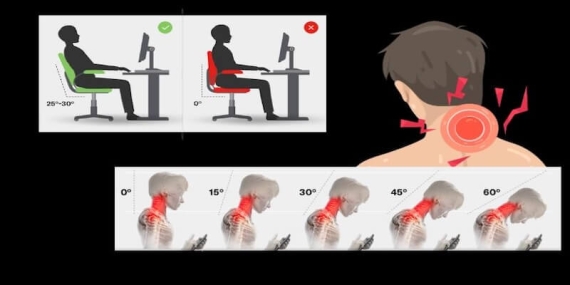 Boyun Ağrısı Günümüzde Neden Çok Arttı? Modern Yaşamın Sessiz Epidemisi