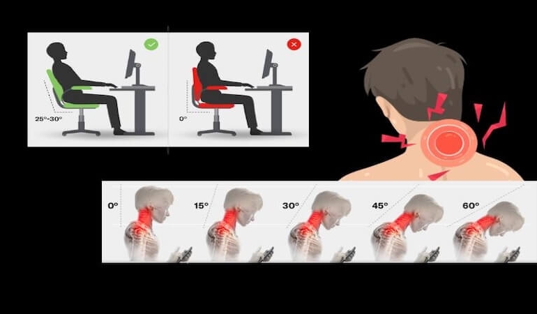 Boyun Ağrısı Günümüzde Neden Çok Arttı? Modern Yaşamın Sessiz Epidemisi