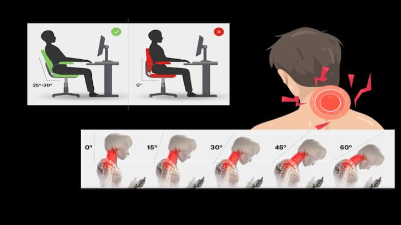 Boyun Ağrısı Günümüzde Neden Çok Arttı? Modern Yaşamın Sessiz Epidemisi