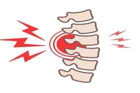 Osteoporozda Omurga Kırıkları